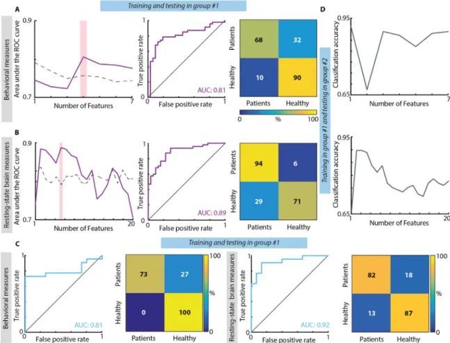 Fig. 4. Canonical correlation analysis between behavioral and CVs of EEG-SVD. (A) Canonical correlation coe ﬃ cients for laterality indices (i.e., LI and F) (left panel) and for CVs of the EEG-SVD components (right panel) for the ﬁ rst canonical component 