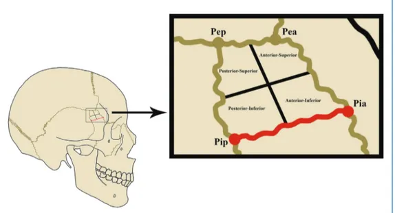 Figure 5. Right external and internal pterion on the skull is shown. These areas are divided into 4 quadrants: