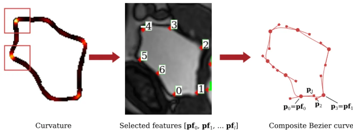 FIGURE 3 The tracking principle: an organ contour defined by a composite Bezier curve, the joined points (features) are selected by high curvatures