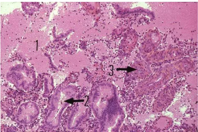 Figure 4 : endomètre en phase menstruelle (HES, x 40)   