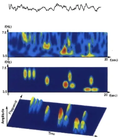 Figure 6-1:  Bump modeling:  the original  EEG signal  (top) is transformed  in time-frequency domain  (second  from  top)