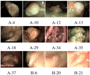 Fig. 9. Lesions correctly classified by the best model and wrongly by all humans.