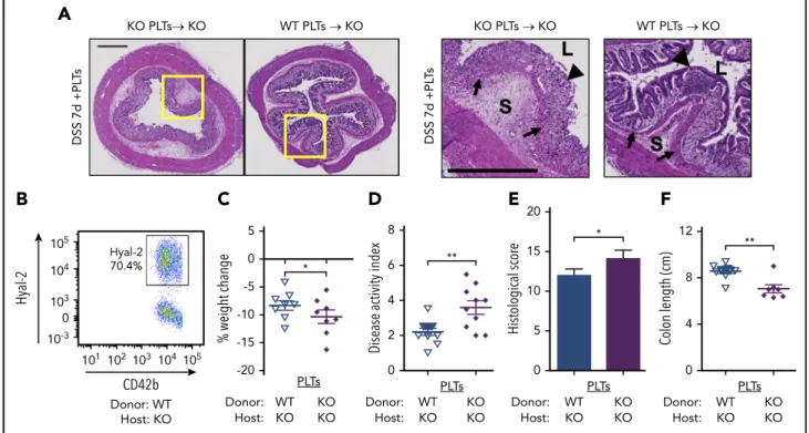 Figure 4. Platelet HYAL2 mediates susceptibility to colitis. Mice received adoptive transfer of 83 10 8 WT or KO platelets as indicated at the onset of DSS treatment