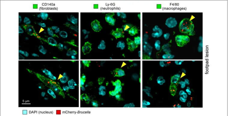 FIGURE 3 | Following intradermal infection with Brucella melitensis, fibroblasts, neutrophils, and macrophages were found to be infected in the footpad lesion.