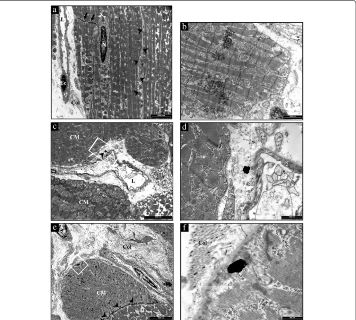Fig. 7 TEM analysis of the heart from a representative untreated CTRL and TiO 2 -NP treated SHR