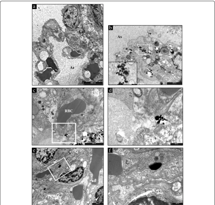 Fig. 6 Ultrastructural features of the alveolar lung parenchyma from a representative untreated CTRL and TiO 2 -NPs treated SHR