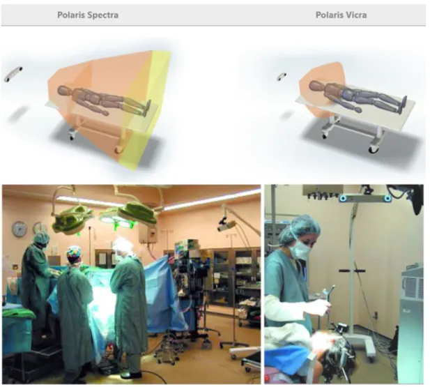 FIGURE 2.10 shows passive markers mounted on a needle used in ablation pro- pro-cedures