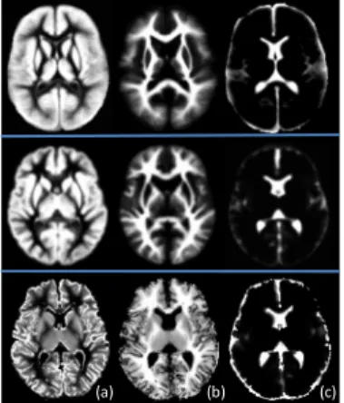 Fig. 7. Illustration of prior probability maps from a population  atlas in [1], our generated neonatal atlas, and the proposed  subject-specific atlas, from top to bottom