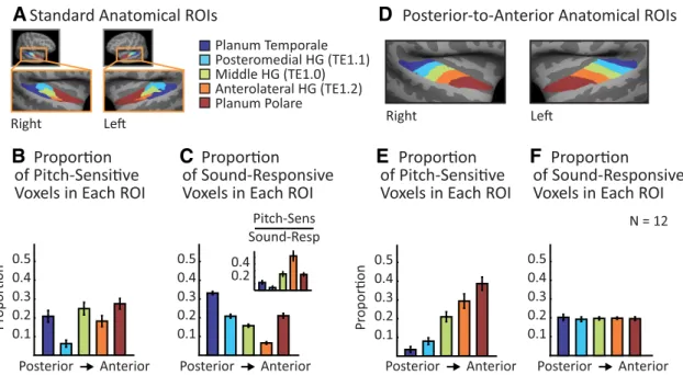 Figure 4. Anatomical distribution of pitch responses across auditory cortex. A, Standard anatomical ROIs displayed on an inflated average brain