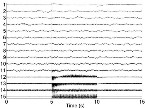 Figure 2.25: Decomposed sources by SSA-GEVD using a dataset with 10 mixed SEEG sources and SNR