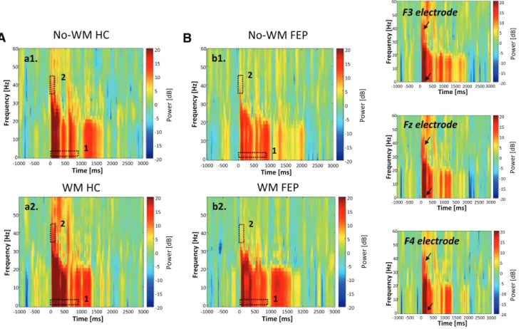 Fig. 3   Grand average frontal spectrograms from short-time fast Fou- Fou-rier transform (STFFT) of EEG