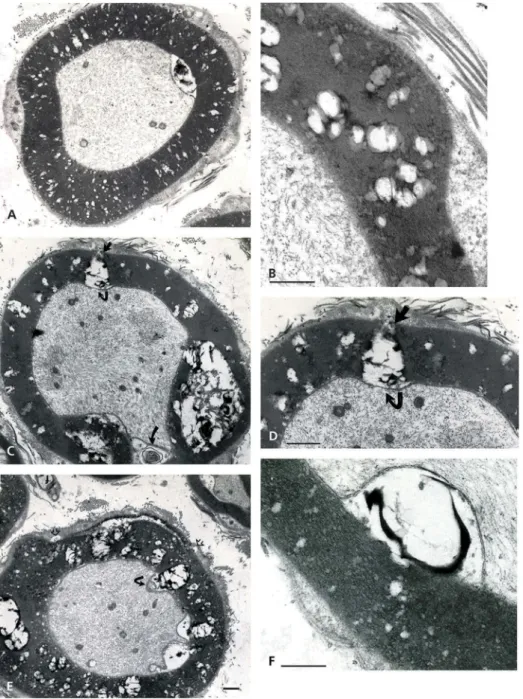 Figure 12. (a – f): TEM aspects of obese Zucker rat sciatic nerve obtained out of thick ultrathin (&gt;500 nm)
