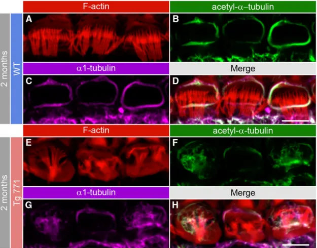 Figure 9. Acetylated microtubules populate the cuticular plate center in the diap3-overexpressing mice