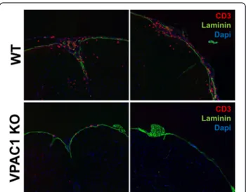 Fig. 4 VPAC1-deficient mice exhibit reduced immune cell infiltration into the CNS meninges and parenchyma after EAE induction
