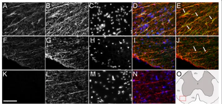 Fig. 3 Astrocytic SULT1A immunoreactivity in the EAE and control white matter spinal cord