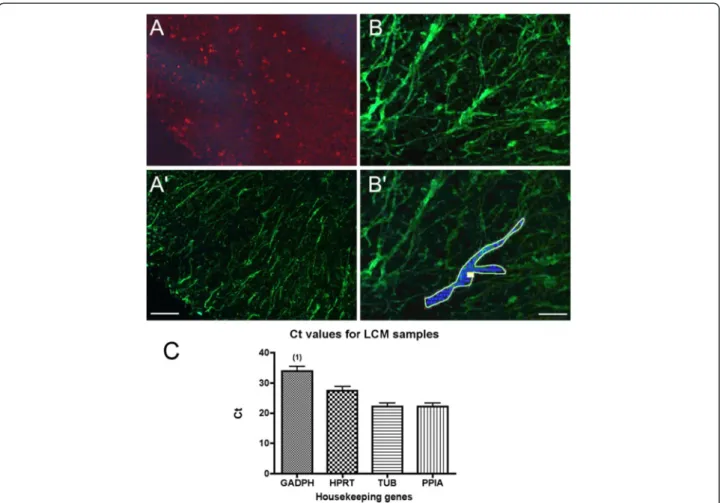 Fig. 1 Immunolabeled LCM-astrocytes and housekeeping gene expression. a, b Example of immunostainings of T cells and astrocytes in white matter spinal cord (here ventrolateral part as in Fig