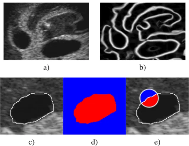 Fig. 4. (a) A cropped US image. (b) The corresponding phase-congruency measure (Eq. (16))