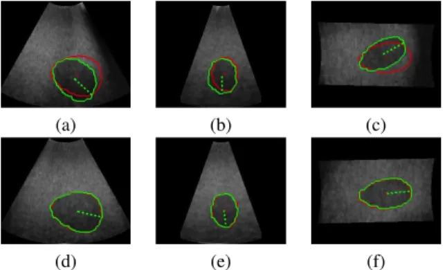 Fig. 6. Positioning task with six features extracted from three orthogonal images. (a-c) Initial object cross-section (in green) with the desired contour to reach (in red)