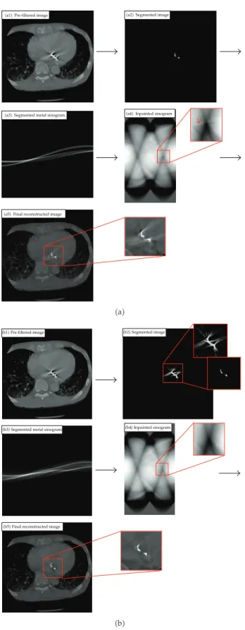 Figure 5: Artifact correction on ClinicalImage1 Figure 3a using: a, Bal’s algorithm 7; b, our proposed method.