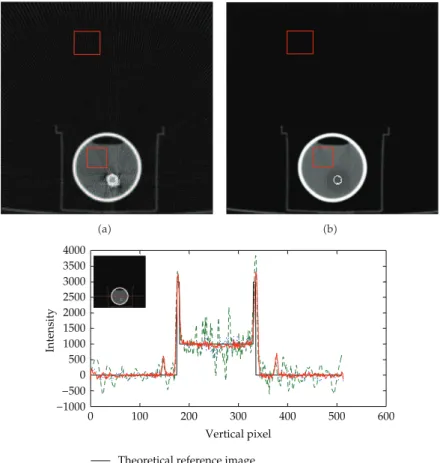 Figure 8: Line profile comparison for diﬀerent artifact corrections. a corrected image using Bal’s algorithm;  b  corrected image using our method;  c  line profiles along a given line in the original image and each corrected image