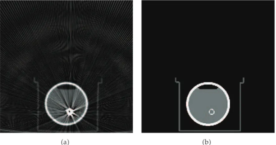 Figure 4: Simulated CT images including metal artifacts. a Phantom image including simulated metal artifact PhantomImage; b the original artifact-free phantom image used to create PhantomImage
