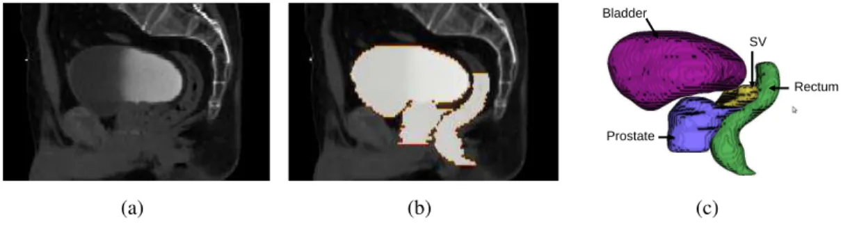 Figure 2. Selected template. Sagittal views of the a) original CT scan, b) the organ delineations, and c) 3D representation