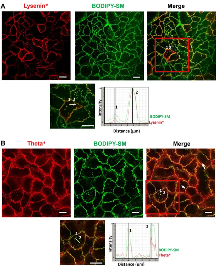 Fig. 4. SM-rich domains are associated with cholesterol: A. Living keratinocytes were labelled with lysenin*, then with BODIPY-SM