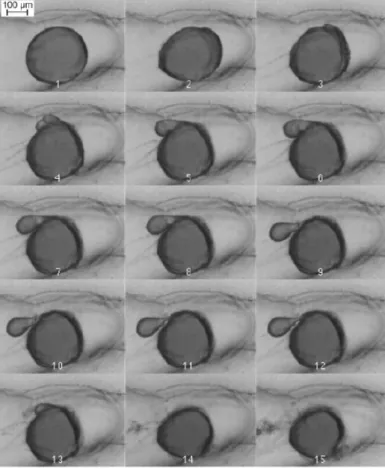Figure 2.6 – Série de photographies au microscope montrant l’évolution de la fragmenta- fragmenta-tion d’une gouttelette d’huile sur 16 jours