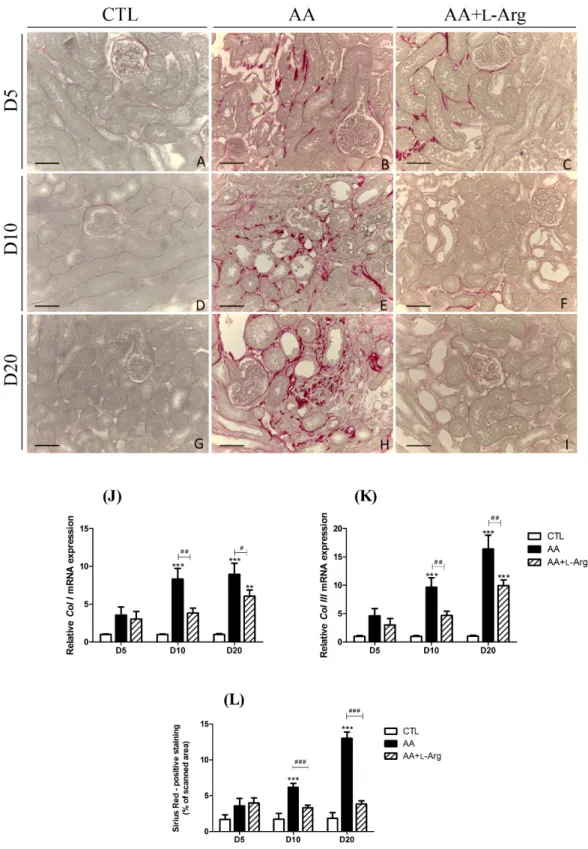 Fig 4. Effect of L-arginine supplementation on Sirius Red staining at days 5, 10 and 20 in CTL, AA and AA +L-Arg mice