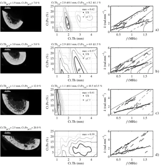 Figure 6: Illustration of inverse problem solutions for typical radius specimens: µ-CT transverse cross- cross-section (left), objective function Proj(Ct.Th,Ct.Po) associated with the best acquisition (center) and optimal matching between the experimental 