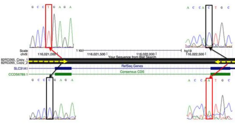 Fig.  9.  Compound heterozygosity of  SLC31A1 in a patient with a previously  unsolved lysosomal  storage disease