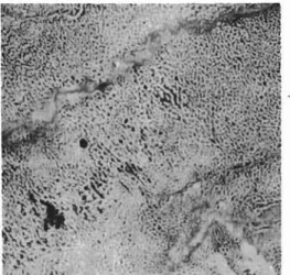 Figure 4 Reticuloid