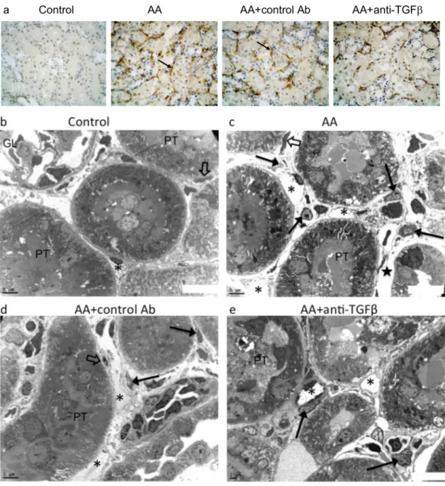 Fig 8. Representative photomicrographs of platelet-derived growth factor receptor beta (PDGFR β ) expression in the kidney tissues