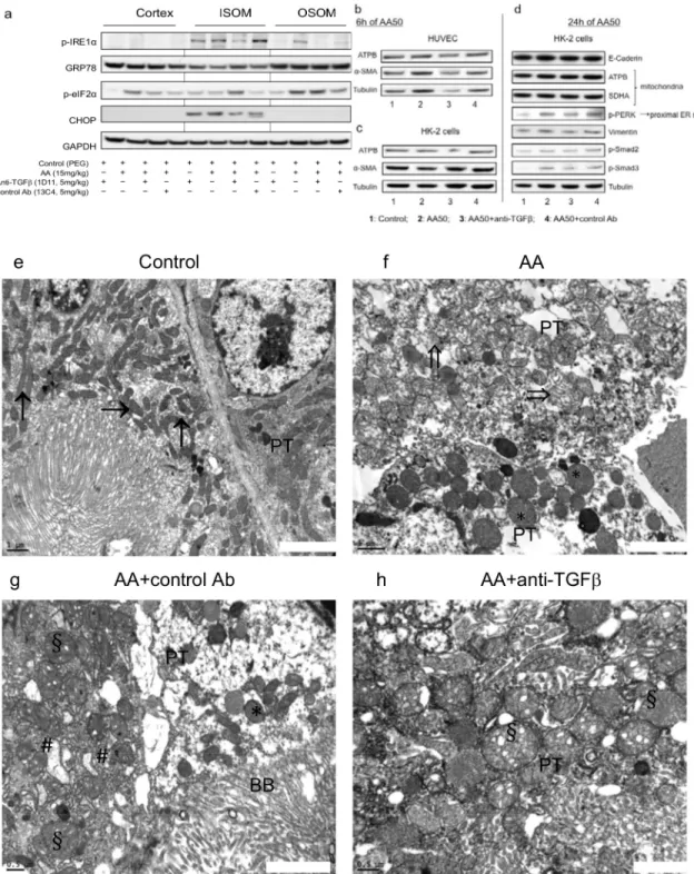 Fig 9. Anti-transforming growth factor beta (TGF β ) Ab decreased aristolochic acid (AA)-induced reticulum endoplasmic (ER) and mitochondrial (MT) stress protein expression in kidney tissue