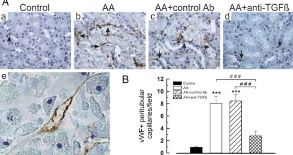 Fig 10. Anti-transforming growth factor beta (TGF β ) Ab attenuated peritubular capillary density in vivo and endothelial cells injury in vitro induced by aristolochic acid (AA)