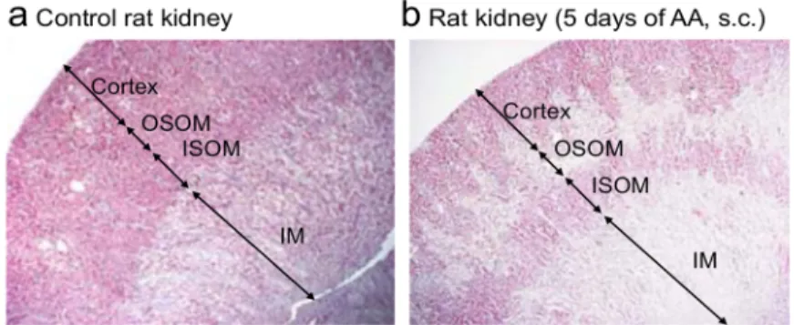 Fig 3. Anti-transforming growth factor beta (TGF β ) Ab suppressed p-Smad2/3 signaling in the kidney induced by aristolochic acid (AA) and attenuated acute kidney injury
