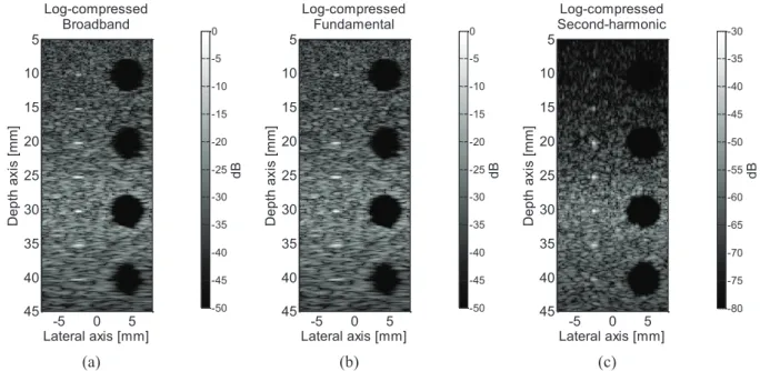 Figure 1.8: Illustration of a (a) broadband B-mode image log-compressed, (b) fundamental B-mode image  log-compressed and (c) second-harmonic image log-compressed