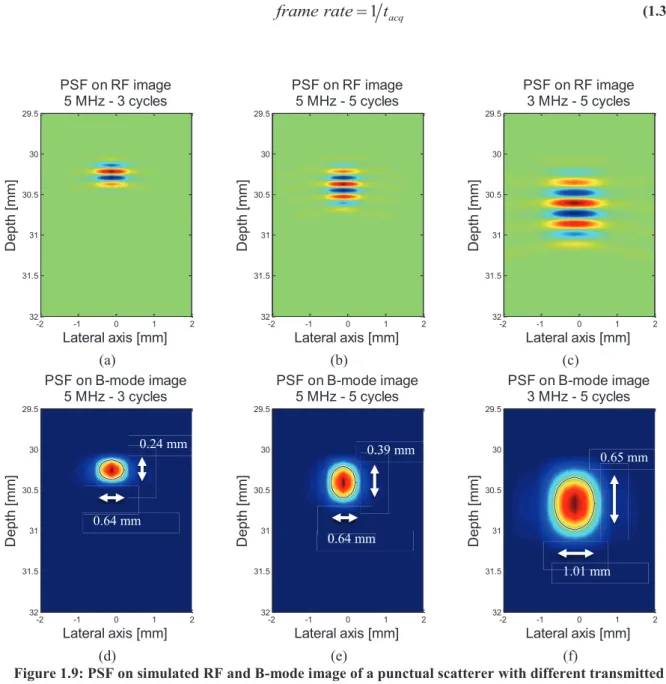 Figure 1.9: PSF on simulated RF and B-mode image of a punctual scatterer with different transmitted  parameters