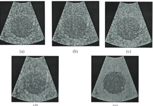 Figure 2.2: Images of a phantom, normalized to constant mean background gray level at 3.5 MHz and  their CNR