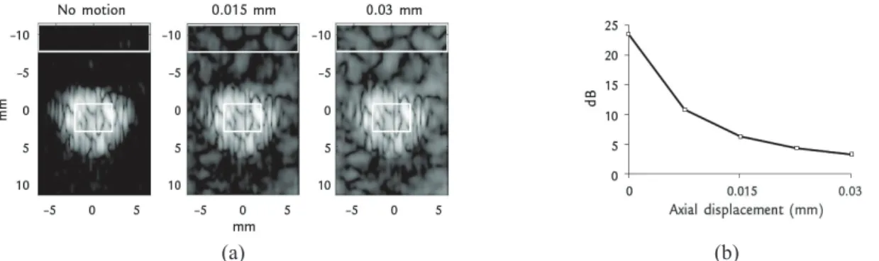 Figure 2.10: B-mode images of pulse inversion technique of Levovist ®  microbubbles associated with (a)  different axial motions between the positive and negative pulses, 0 mm, 0.015 mm and 0.03 mm and (b) 