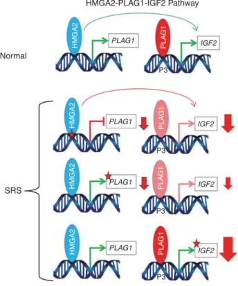 Figure 3 Schematic representation of the HMGA2–PLAG1–IGF2 pathway in a normal individual and in Silver – Russell cases