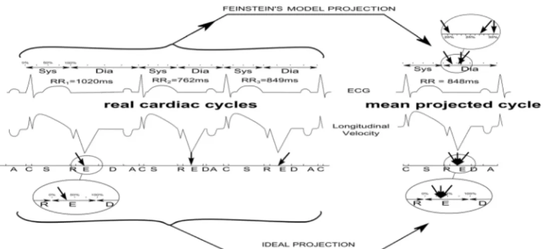 Fig 1. Illustration of the reconstruction process consisting in projecting several cardiac cycles with beat-to-beat variations into a mean cardiac cycle