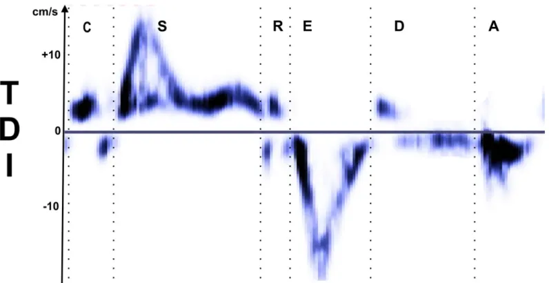 Fig 2. Example of myocardial velocity curves in the longitudinal axis and definitions of the six cardiac phases (C, S, R, E, D, and A) used in this study