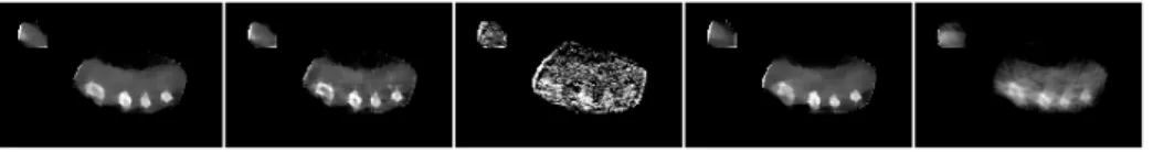 Fig. 7. Results on the in-vivo hand with different priors (selected slice). Left-to-right: