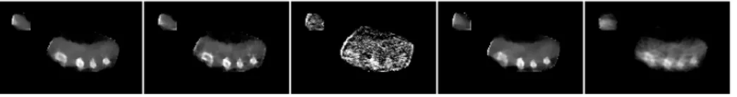 Fig. 7. Results on the in-vivo hand with different priors (selected slice). Left-to-right: