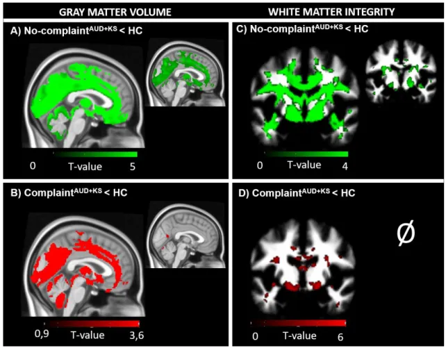 Figure 3: Structural brain abnormalities in patients with and without sleep complaint compared 602 