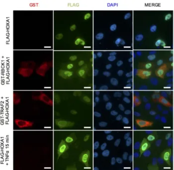 Figure 5. Effect of RBCK1, TRAF2 and TNF ␣ on the HOXA1 intracel- intracel-lular localization