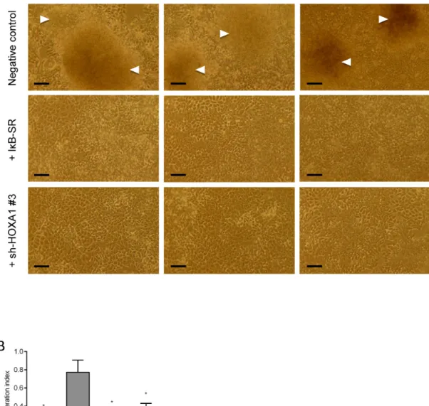Figure 8. Oncogenicity tests. (A) Foci formation assay was performed by transfecting MCF7 cells with empty vector (negative control), I ␬ B-SR or sh- sh-HOXA1 #3