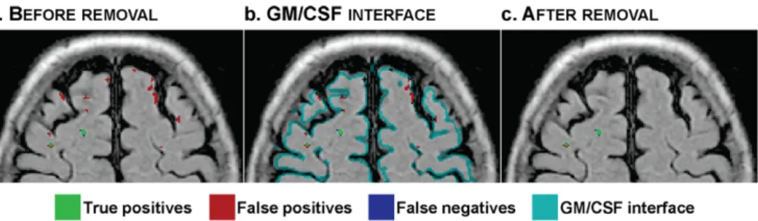 Figure 3. Removal of false positives.