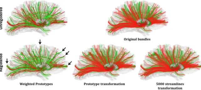 Fig. 10. On the left: registration between the green source bundle and the red target bundle approximated with weighted prototypes